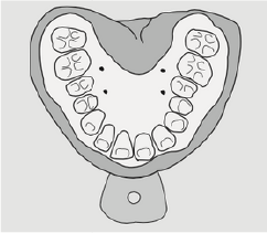 Elaboración del molde
